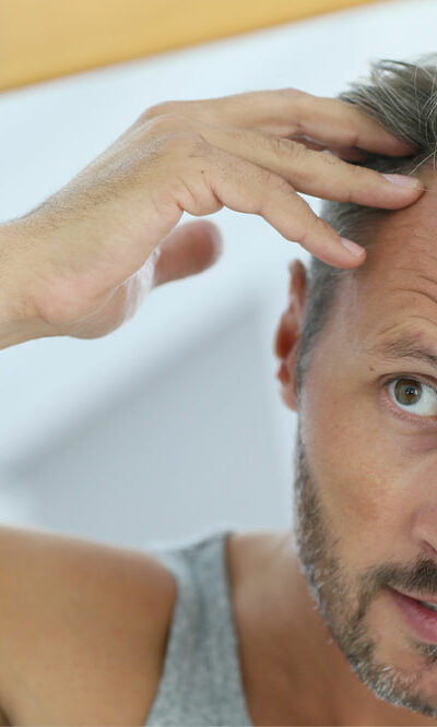 7 Medical Conditions That Can Trigger Hair Loss