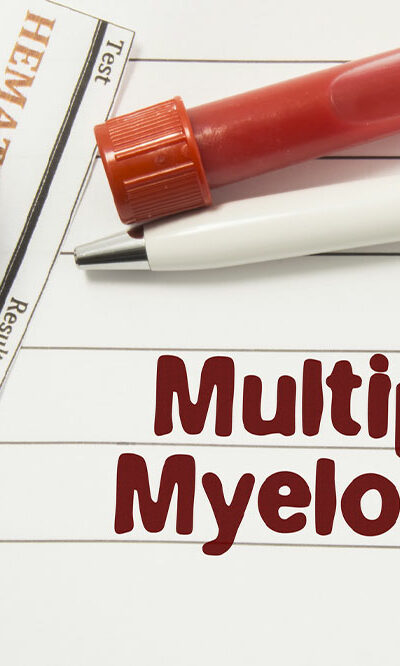 7 Warning Signs and Symptoms of Multiple Myeloma