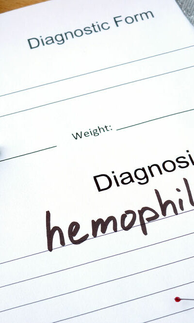 8 signs and symptoms of hemophilia