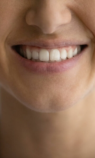 Easy remedies to whiten teeth at home