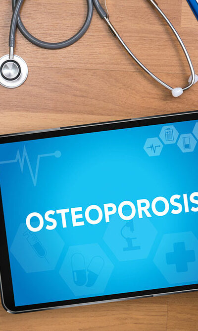 Follow these eating habits and other tips to manage osteoporosis