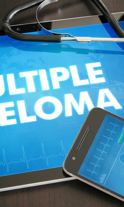 Multiple Myeloma – Signs and Management Tips