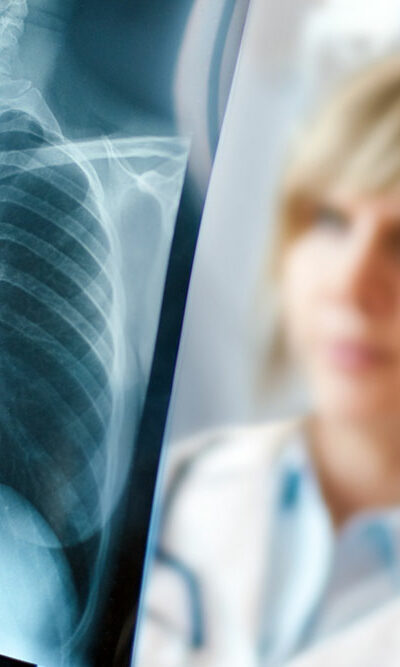 Signs and symptoms that may indicate lung diseases