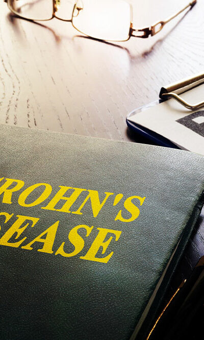 Warning signs of Crohn’s disease