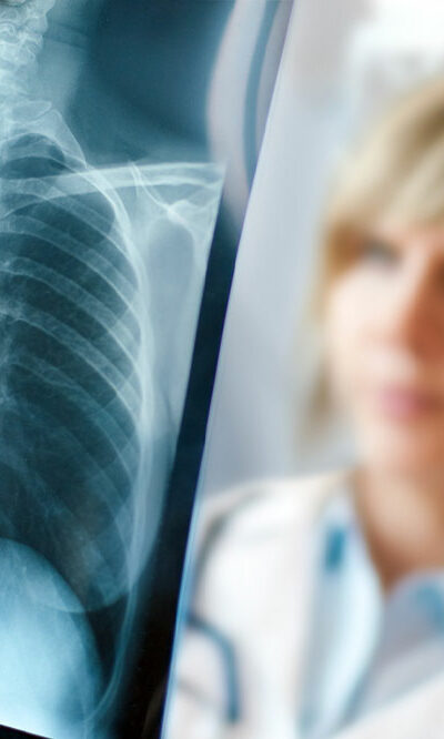 Types and early signs of lung cancer